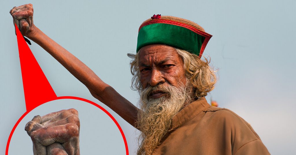 Mystery of the Upright Arm: Indian Man's Decades-Long Defiance ...