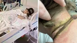 Mother Issues Grim Warning After Teen Nearly Dies in Terrifying Phone Charger Accident