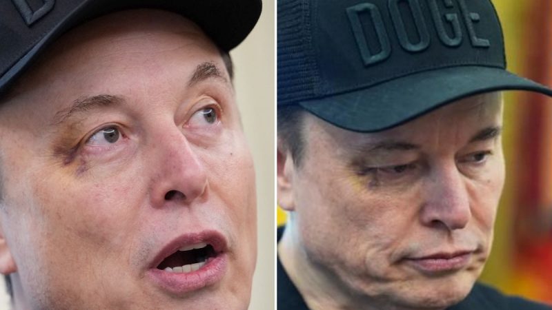 Elon Musk Finally Addresses Black Eye Spotted at White House Farewell Event