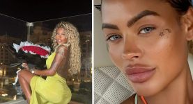 Influencer Still Eyeing Cosmetic Enhancements Despite Spending Over $85,000 Fixing Bum Implants That ‘Fell Out’ at the Gym