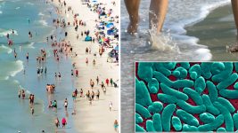 Flesh‑Eating Bacteria Leaves 4 People Dead in Florida as Health Officials Issue Stern Warning