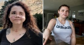 Woman Given ‘Less Than 2%’ Chance of Survival After Being Shot in the Face Shares Urgent Message About Surviving Horrific Trauma