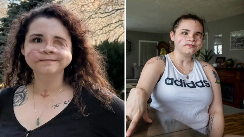 Woman Given ‘Less Than 2%’ Chance of Survival After Being Shot in the Face Shares Urgent Message About Surviving Horrific Trauma