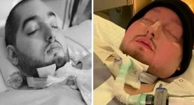 ‘Sleeping Prince’ Dies After Spending 20 Years in Coma Following Devastating Car Crash
