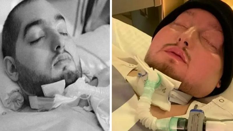 ‘Sleeping Prince’ Dies After Spending 20 Years in Coma Following Devastating Car Crash