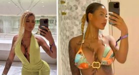 Influencer Forced to Spend Over $85,000 on Corrective Surgery After Bum Implants ‘Fell Out’ in the Gym