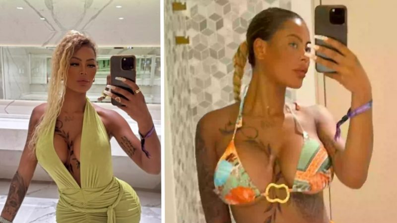 Influencer Forced to Spend Over $85,000 on Corrective Surgery After Bum Implants ‘Fell Out’ in the Gym