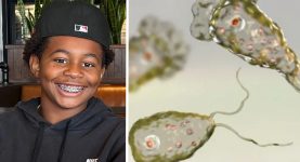 12‑Year‑Old Boy Dies After Contracting Brain‑Eating Amoeba at Popular Swimming Spot