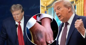Trump Dismisses Health Rumors as ‘Fake News,’ Insists He’s Stronger Than Ever