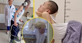 Boy Once Known as ‘Folded Child’ Stands Tall After Life-Changing Surgery