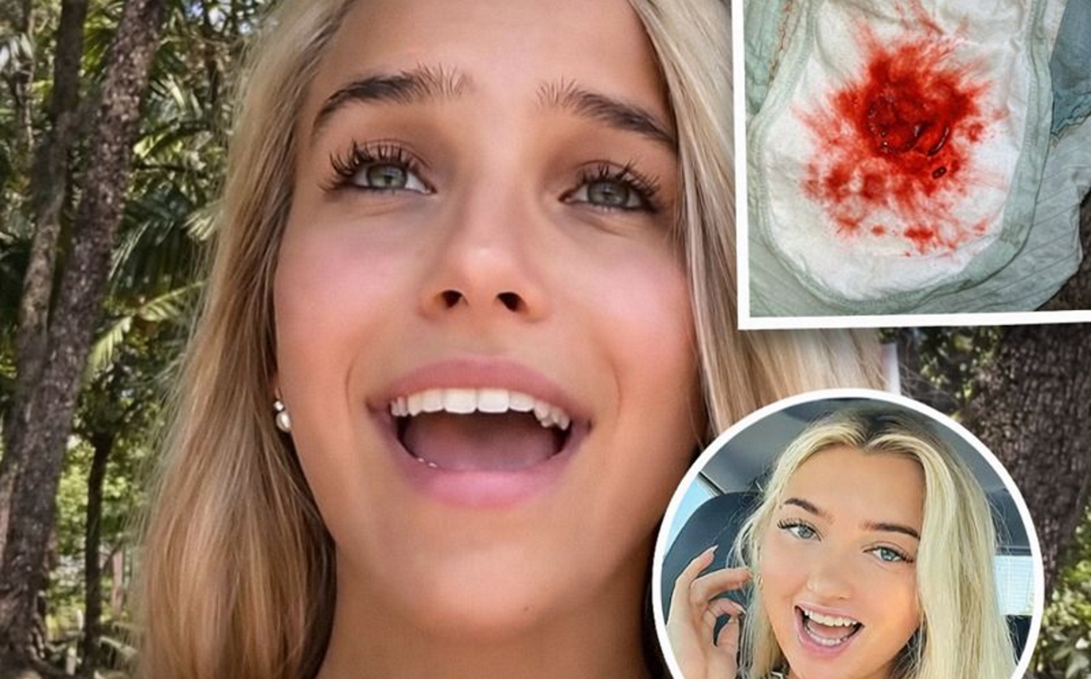 Bleeding Trend Raises Alarms as Gen Z Pushes Dangerous Online Boundaries