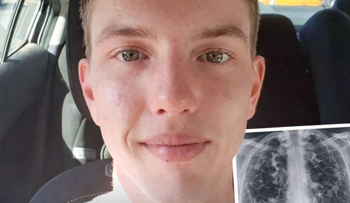 Man, 28, Dies Suddenly After Doctors Discover 72 Holes in His Lungs