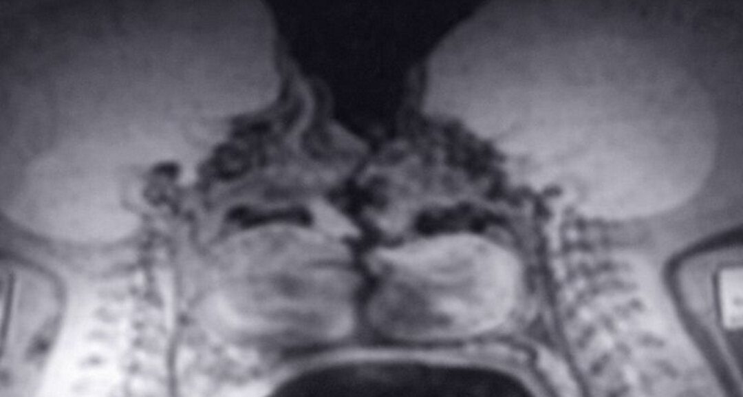 Scientists Stunned After MRI Sex Experiment Reveals One Moment They Still Can’t Explain