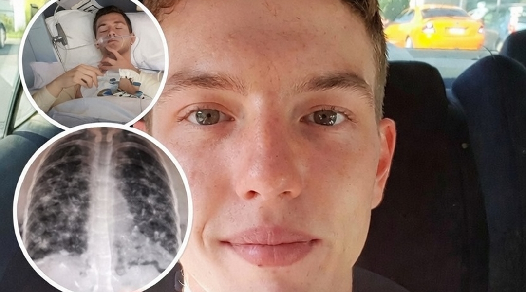 Doctors uncover dozens of punctures in a young man’s lungs before his sudden death at 28